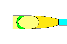 thining of overall(pattern A-2)